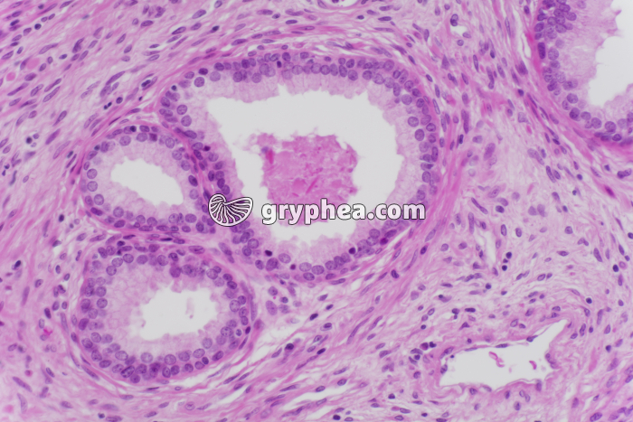 Prostate x100 - gryphea.com